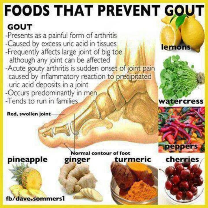 Occurence and prevention of gout: what foods to avoid and which foods to embrace?