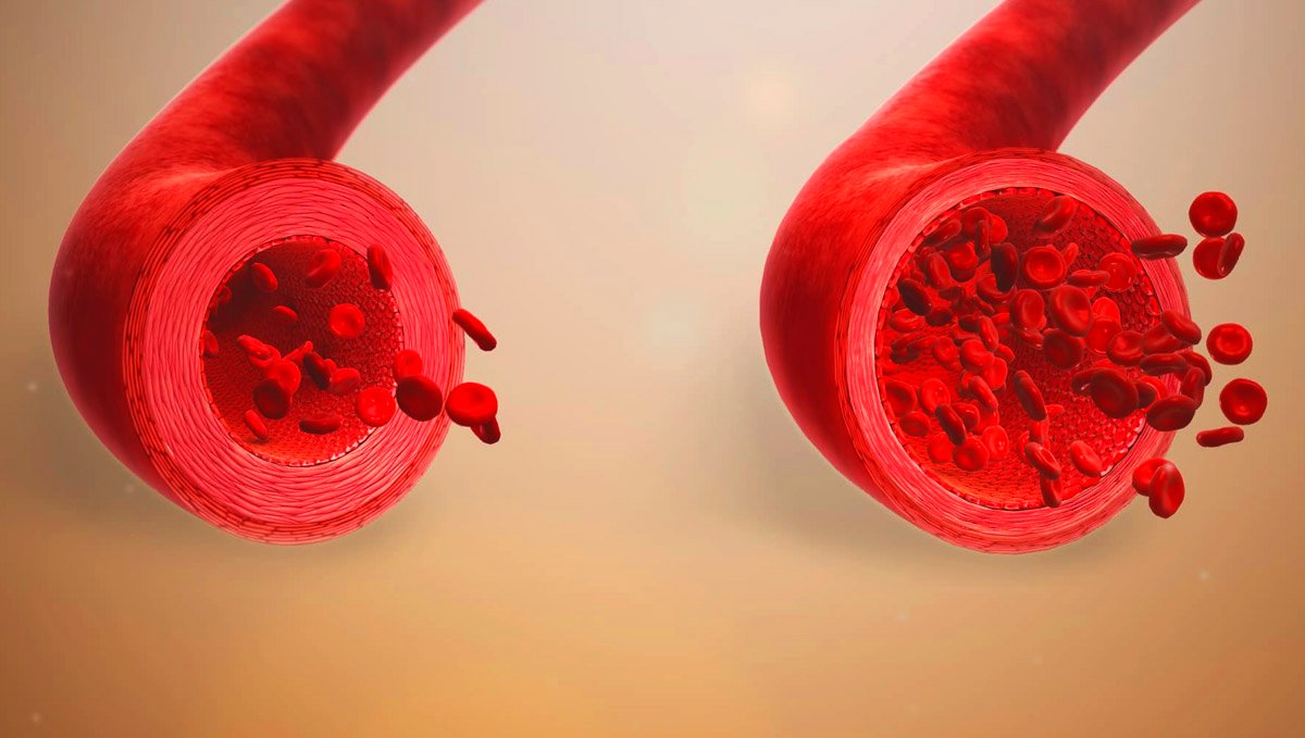 Nitrogen and vasodilation. On how vasodilating NO boosters provide important health benefits