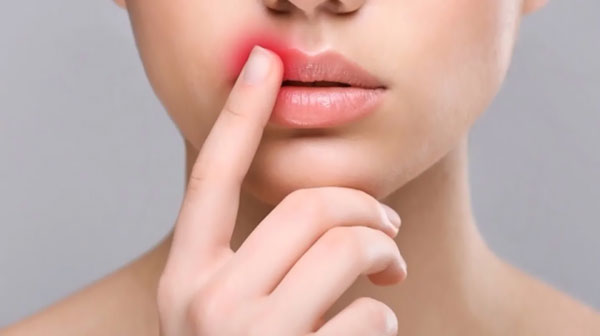 Why do people experience more infections with herpes virus after vaccination against or infection with COVID?