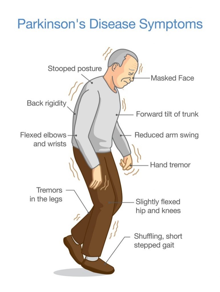 How to recognize symptoms of Parkinson's disease early on