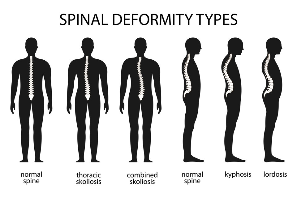 How common are spinal or foot abnormalities?