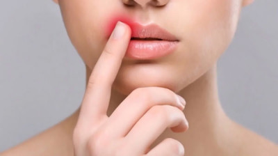 Why do people experience more infections with herpes virus after vaccination against or infection with COVID?