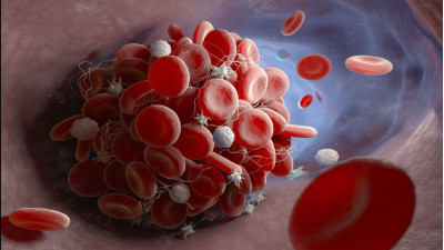 Thrombosis, blood clotting and vitamin K