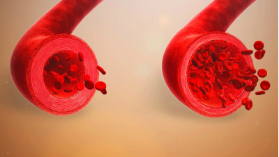 Nitrogen and vasodilation. On how vasodilating NO boosters provide important health benefits