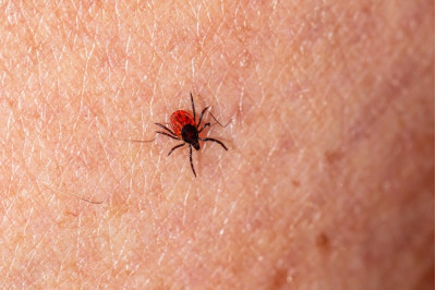Lyme disease : what is it and how can it be treated?