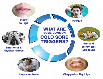 Smile, don't kiss! How to prevent cold sores.