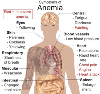 Uitgeput als gevolg van bloedarmoede